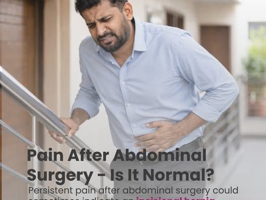 incisional-hernia-causes-treatment