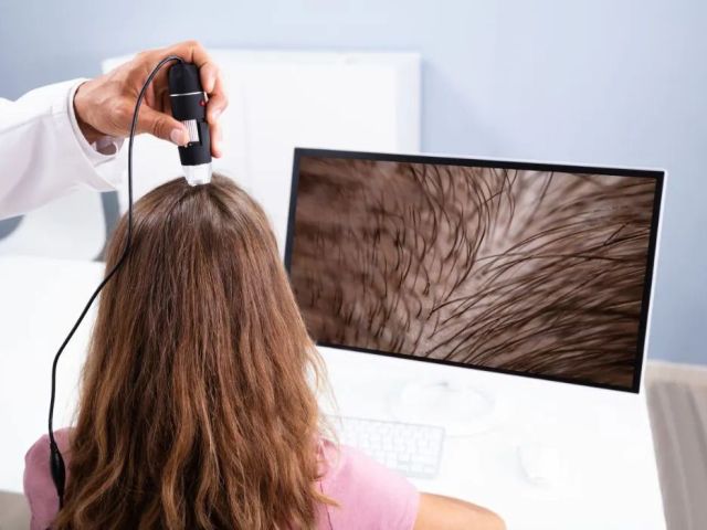 best-hair-fall-treatment-in-gurgaon