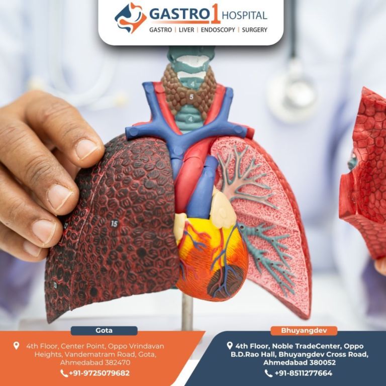 best-liver-cancer-treatment-in-ahmedabad-big-0