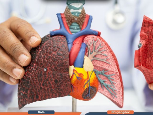 best-liver-cancer-treatment-in-ahmedabad