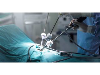 advanced-laparoscopic-surgery-care-small-0