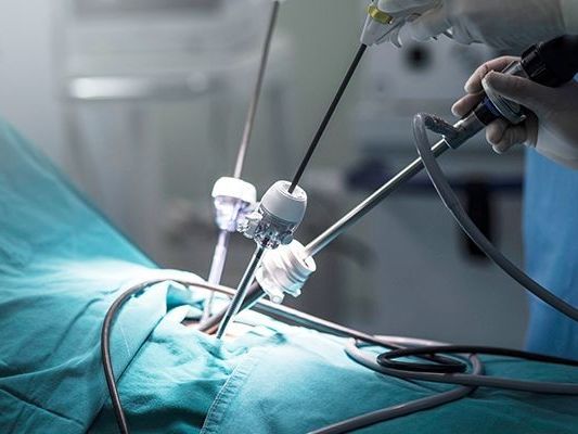 advanced-laparoscopic-surgery-care
