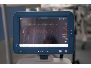 when-is-remote-ecg-diagnostics-recommended-for-patients-small-0