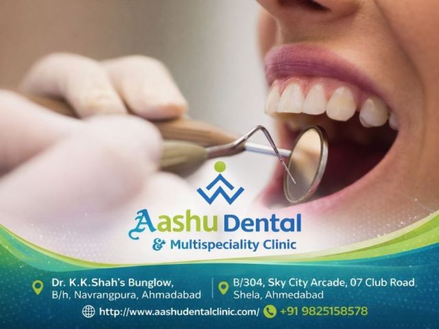 crowns-and-veneers-treatment-in-gujarat-dr-manish-shah