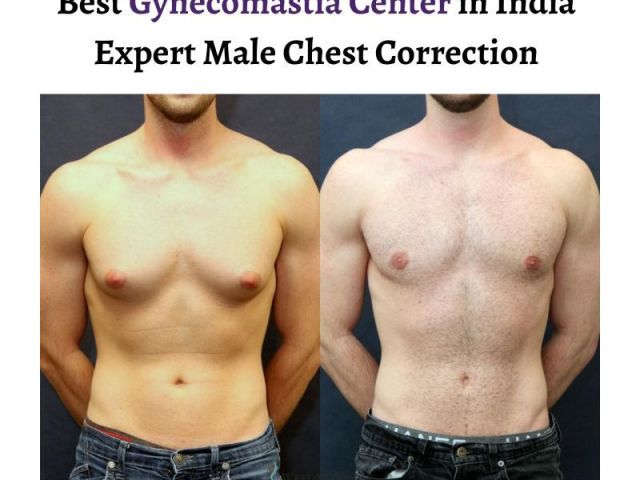 best-gynecomastia-center-in-india-expert-male-chest-correction