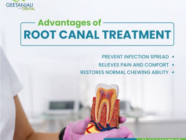 root-canal-treatment-in-gaur-city-for-safe-tooth-care
