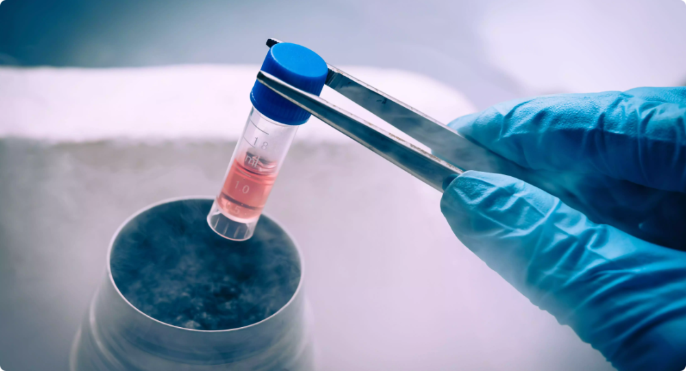 sperm-cryopreservation-dr-archana-dhawan-bajaj-big-0