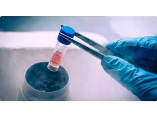 sperm-cryopreservation-dr-archana-dhawan-bajaj-small-0