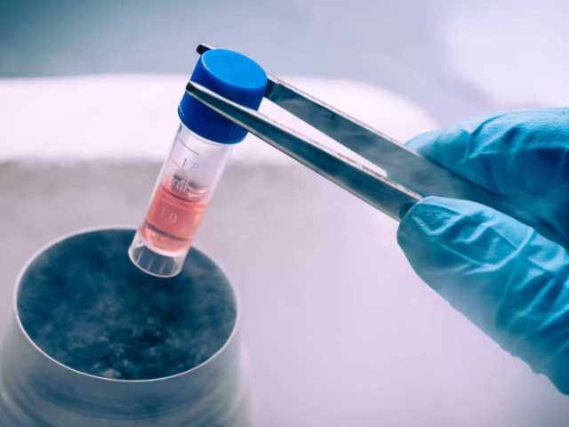 sperm-cryopreservation-dr-archana-dhawan-bajaj