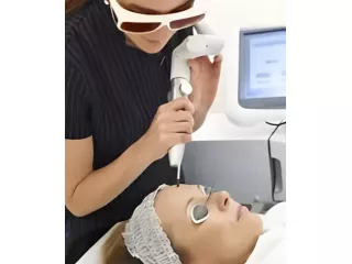 q-switch-laser-skin-pigmentation-treatment-in-coimbatore-small-0