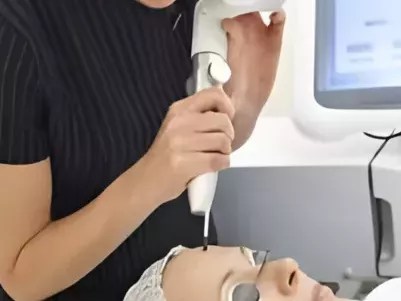 q-switch-laser-skin-pigmentation-treatment-in-coimbatore