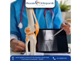 specialized-3d-robotic-total-knee-replacement-in-ahmedabad-small-0