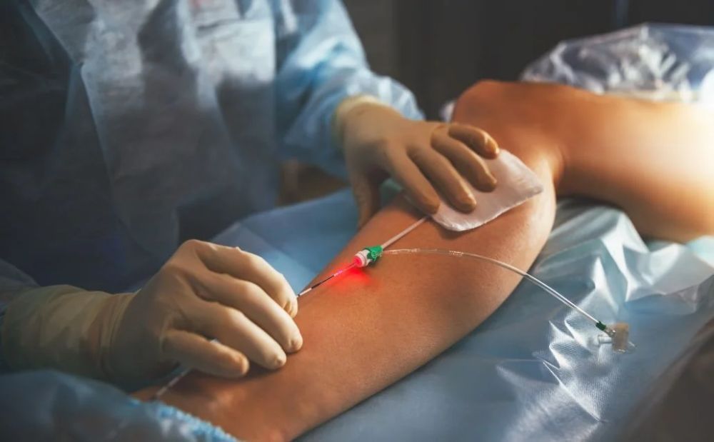modern-technology-for-treating-varicose-veins-big-0