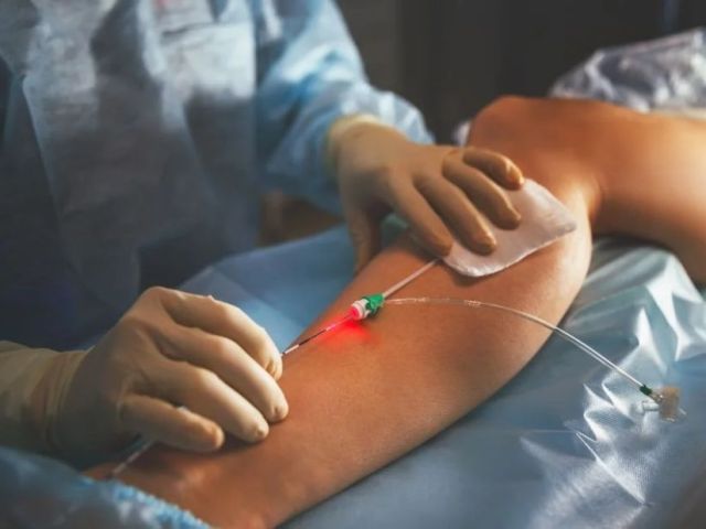 modern-technology-for-treating-varicose-veins