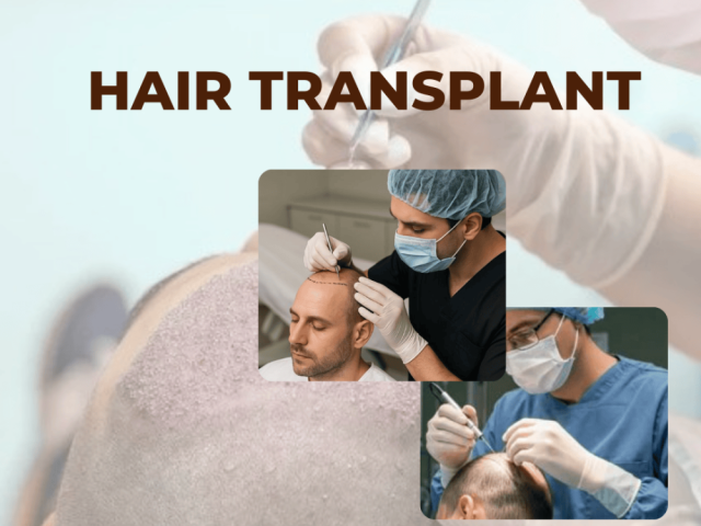 best-hair-transplant-in-ahmedabad-fue-dhi-experts