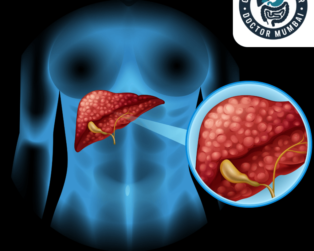leading-liver-transplant-doctor-in-mumbai-with-expert-team
