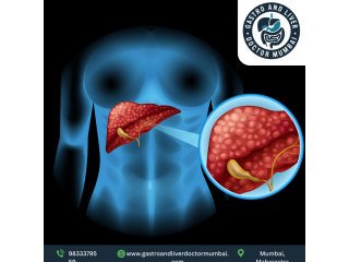 leading-liver-transplant-doctor-in-mumbai-with-expert-team-small-0