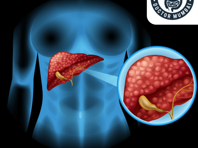 leading-liver-transplant-doctor-in-mumbai-with-expert-team