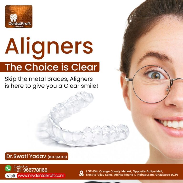 aligners-treatment-for-teeth-straightening-in-indirapuram-big-0