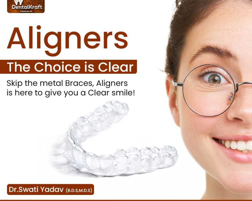 aligners-treatment-for-teeth-straightening-in-indirapuram