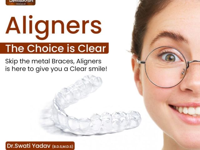 aligners-treatment-for-teeth-straightening-in-indirapuram