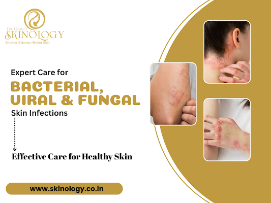 expert-care-for-skin-infections-treatment-in-indore