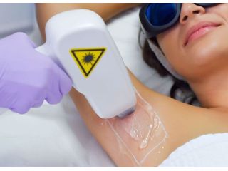 laser-tattoo-removal-safe-effective-advanced-solution-small-3