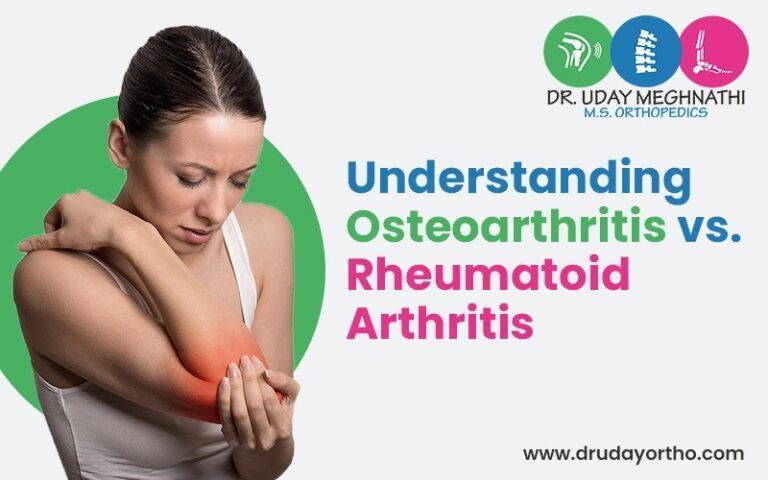 understanding-osteoarthritis-vs-rheumatoid-arthritis-big-0