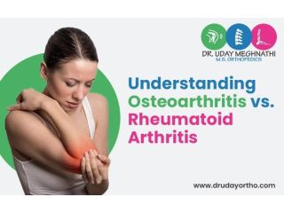 understanding-osteoarthritis-vs-rheumatoid-arthritis-small-0