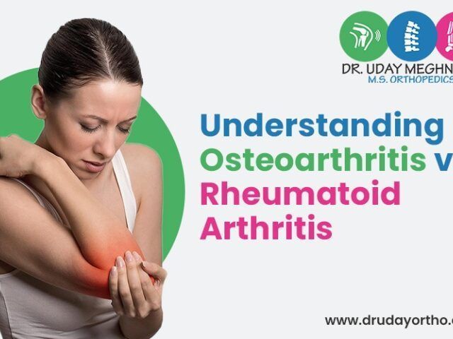 understanding-osteoarthritis-vs-rheumatoid-arthritis