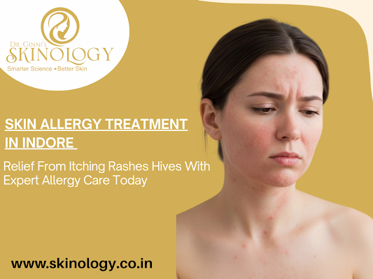 effective-skin-allergy-treatment-in-indore-by-experts