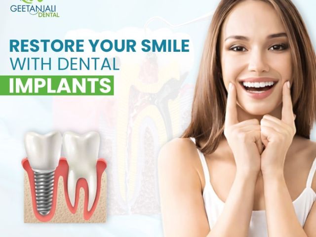 dental-implants-near-gaur-city-for-smile-restoration