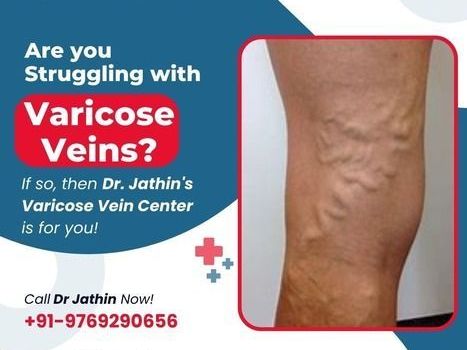 expert-vein-treatment-for-better-circulation-health
