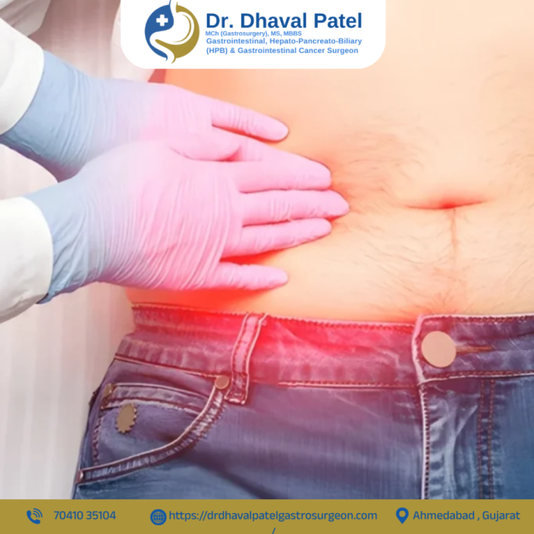 experienced-hernia-surgeon-in-ahmedabad-for-safe-treatment-big-0