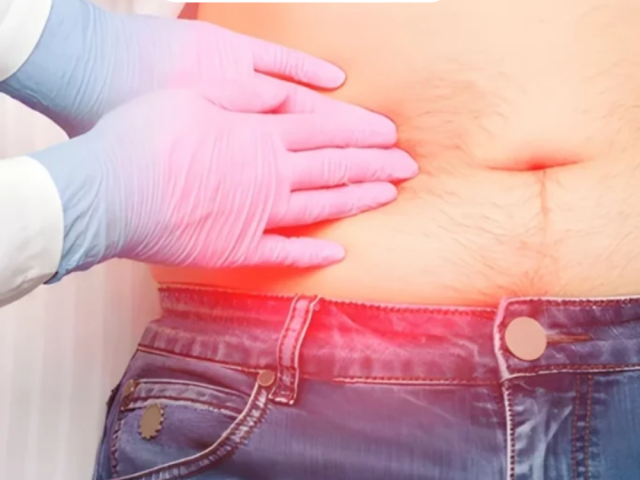 experienced-hernia-surgeon-in-ahmedabad-for-safe-treatment
