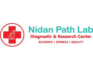 best-lipid-profile-test-in-gandhinagar-small-0