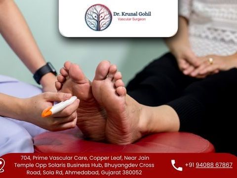 gangrene-treatment-in-india-by-drkrunal-gohil