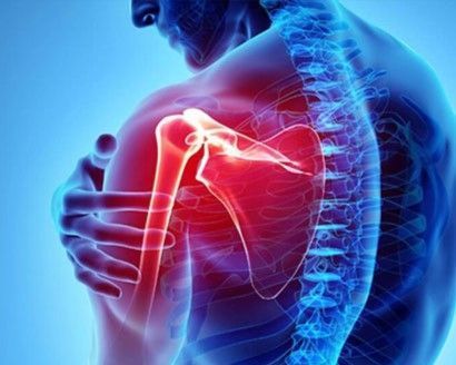 advanced-shoulder-pain-treatment-for-fast-relief-in-kolkata-big-0