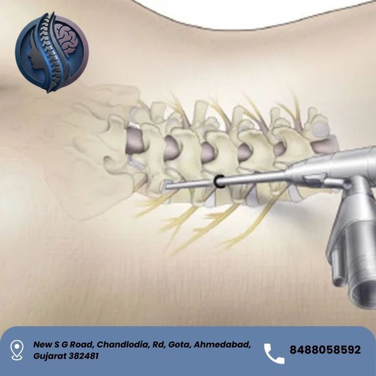 best-endoscopic-spine-surgery-in-ahmedabad-dr-deep-parmar-big-0