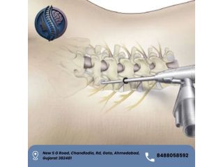 best-endoscopic-spine-surgery-in-ahmedabad-dr-deep-parmar-small-0