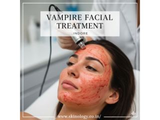 vampire-facial-treatment-in-indore-for-radiant-skin-small-0