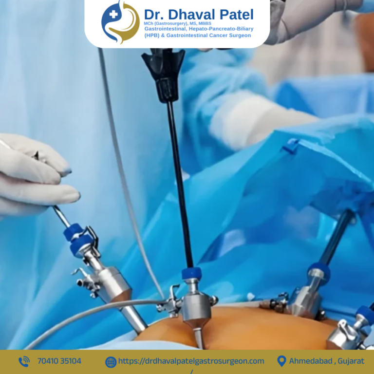 get-safe-laparoscopic-surgery-in-ahmedabad-with-dr-dhaval-patel-big-0