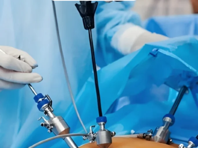 get-safe-laparoscopic-surgery-in-ahmedabad-with-dr-dhaval-patel