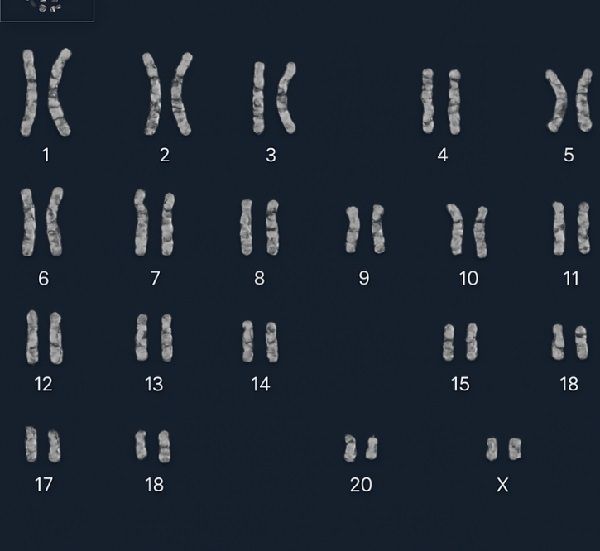 karyotyping-services-chromosome-analysis-for-genetic-testing-big-0