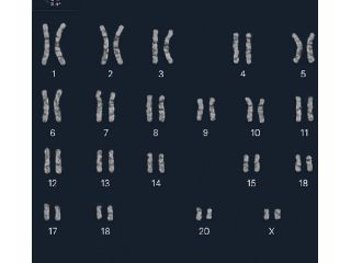 karyotyping-services-chromosome-analysis-for-genetic-testing-small-0