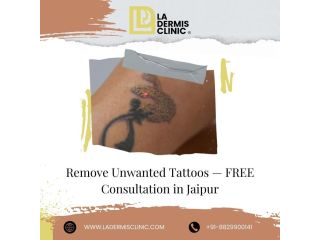 remove-unwanted-tattoos-free-consultation-in-jaipur-small-0
