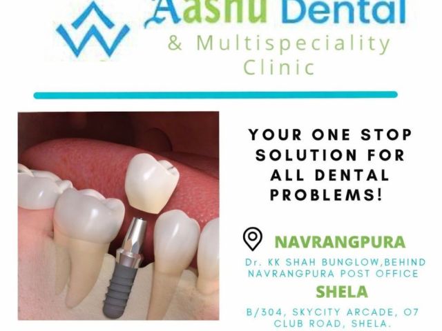 dental-implants-treatment-in-india-dr-manish-shah