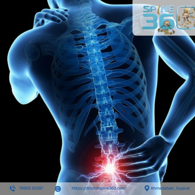 best-spine-surgeon-in-ahmedabad-dr-rohit-thaker-big-0