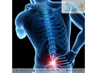 best-spine-surgeon-in-ahmedabad-dr-rohit-thaker-small-0