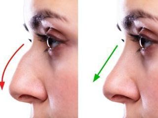best-nose-reshaping-rhinoplasty-surgery-in-coimbatore